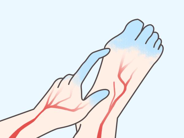 수족냉증의 증상과 치료